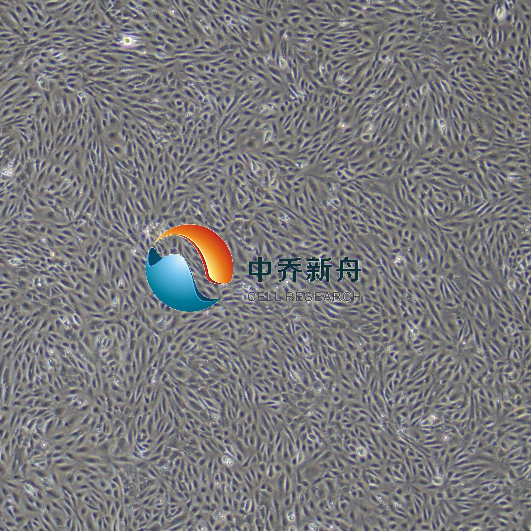 人子宫内膜上皮细胞