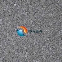 人子宫内膜上皮细胞