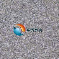  人气管平滑肌细胞