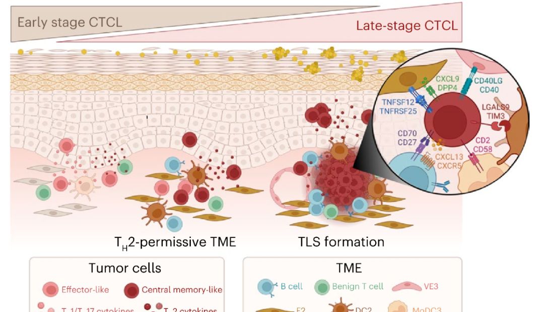 IF 31.2 | 单细胞+空间转录组测序的经典搭配——揭开皮肤T细胞淋巴瘤的秘密