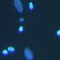 细胞凋亡Hoechst染色