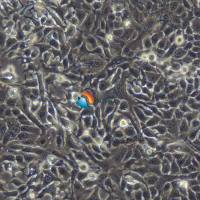 NCI-H1568 [H1568] 人非小细胞肺癌细胞