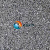 人冠状动脉内皮细胞