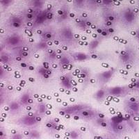 细胞转移transwell法