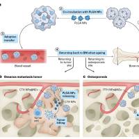 负载甲氨蝶呤（MTX）的聚乳酸-羟基乙酸PLGA纳米颗粒被RGD肽修饰