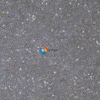 人肺动脉平滑肌细胞