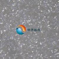 人角膜基质细胞