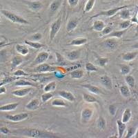 人子宫内膜微血管内皮细胞