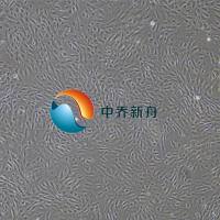 人无色素睫状上皮细胞