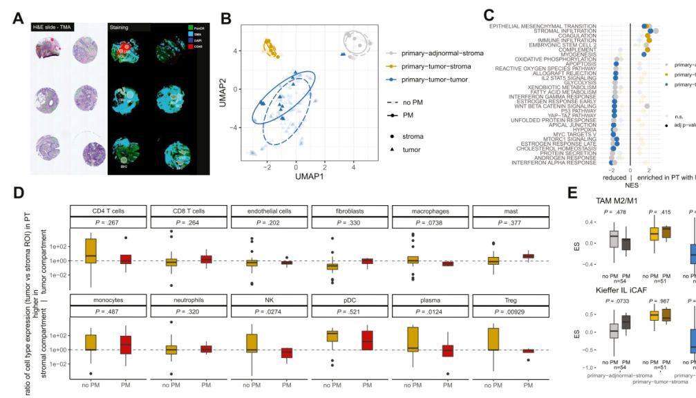 胃肠病领域顶刊 | 最大规模的胃癌腹膜转移多组学研究