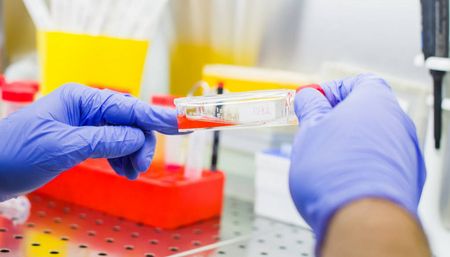 人胃癌细胞MKN-45在药物筛选与机制研究中的应用案例分享