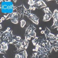 HCT-116 人结肠癌细胞/STR鉴定/镜像绮点（Cellverse）