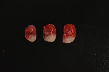 TTC染色.jpg TTC染色.jpg