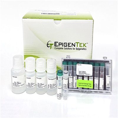 ChIP试剂盒—染色质免疫共沉淀研究完整方案