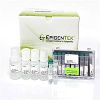 ChIP试剂盒—染色质免疫共沉淀研究完整方案 ChIP试剂盒—染色质免疫共沉淀研究完整方案