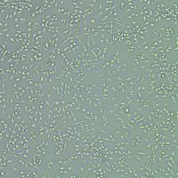 小鼠口腔鳞状细胞癌细胞(MOC2-Cas9)