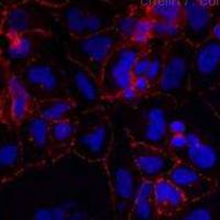 激光共聚焦扫描检测