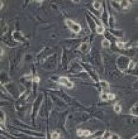 RH-35 (大鼠肝癌细胞系) (种属鉴定正确) RH-35 (rat liver cancer cells) (species identification correct)