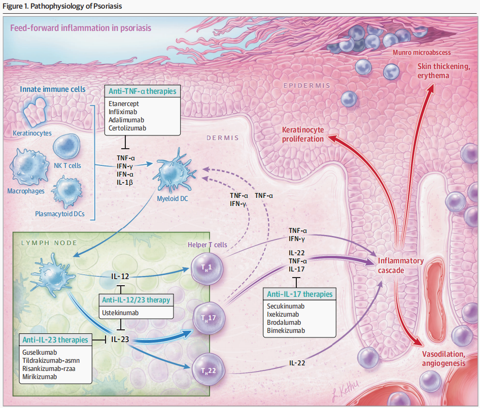 自身免疫疾病简介及人源化靶点介绍