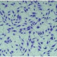 Transwell侵袭实验