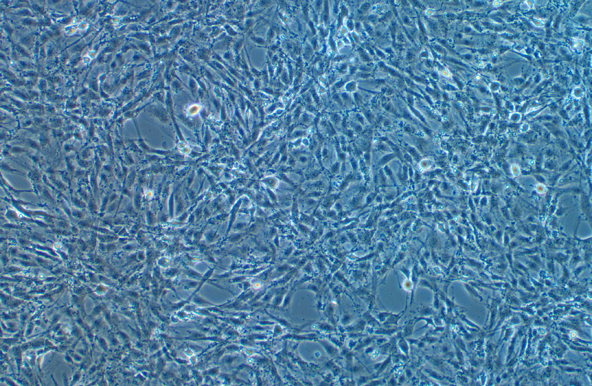 永生化大鼠海绵体内皮细胞应用案例分享