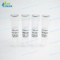 普穆拉病毒糖蛋白1型抗体Glycoprotein 1 of Puumula virus (PUUV) Antibody 货号NBL-240290