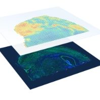 空间转录组分析服务