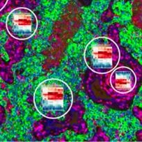 DSP数字空间蛋白组学分析服务