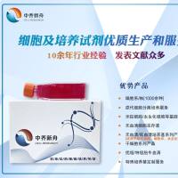 人胃癌组织源成纤维细胞