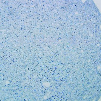 HyClone AdvanceSTEM human somatic stem cell media