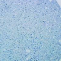 HyClone AdvanceSTEM human somatic stem cell media