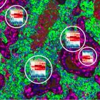 DSP数字空间CTA癌症转录谱分析服务