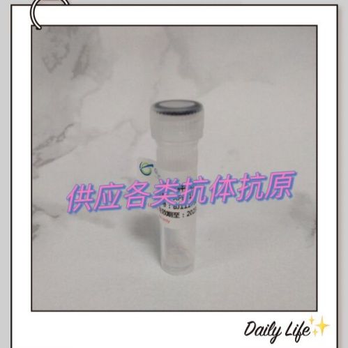 HRP标记的神经元Y连锁蛋白抗体（儿童自闭症相关蛋白）