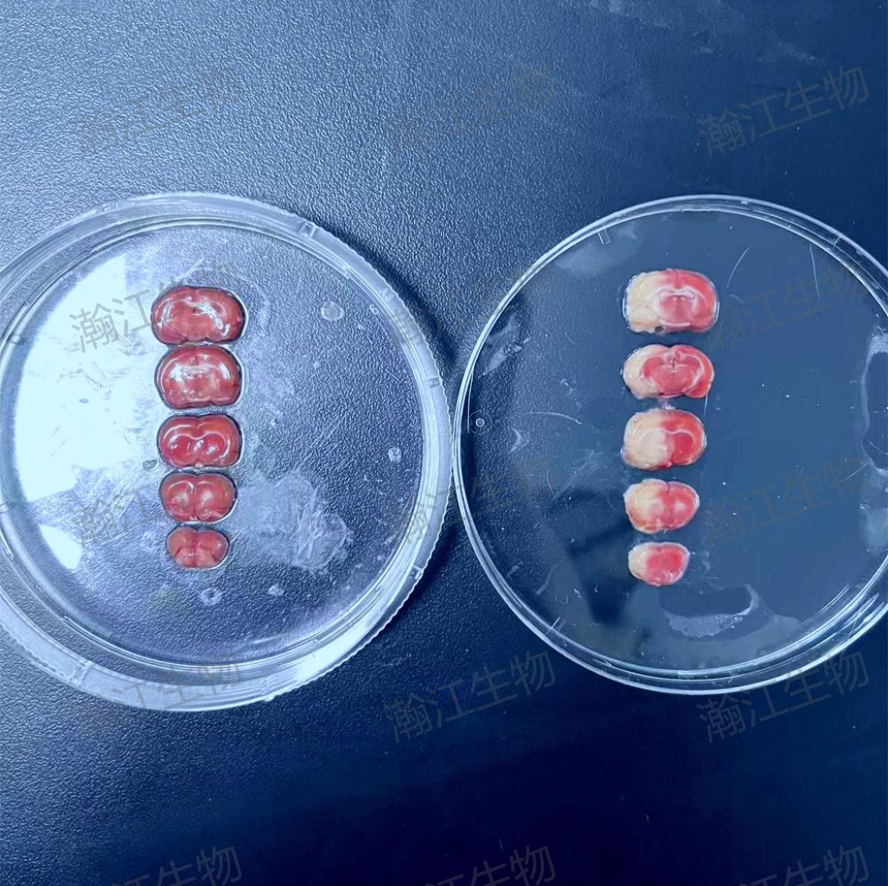 病理染色(油红染色 大体油红 HE染色 Masson染色 天狼星红染色 TTC染色 包埋 切片)