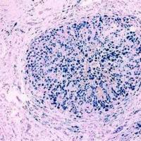 普鲁士蓝染色实验