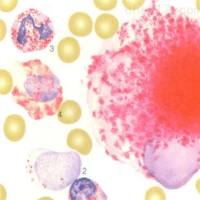 酸性磷酸酶染色（ACP）