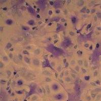 甲苯胺蓝染色实验