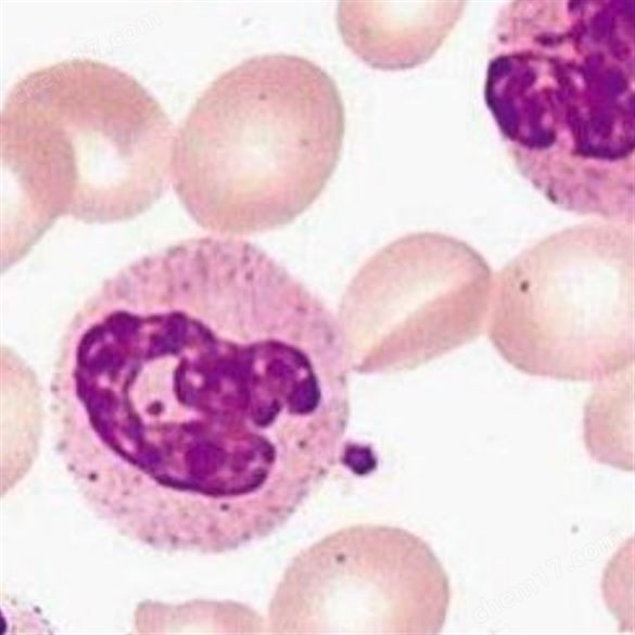 碱性磷酸酶染色( NAP)