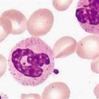 碱性磷酸酶染色( NAP)