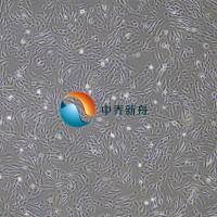 人支气管平滑肌细胞永生化