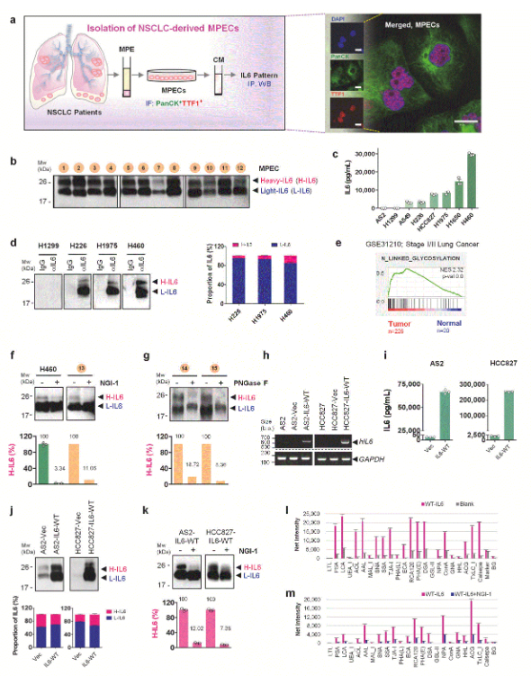 image.png 国立成功大学团队揭示糖基化缺陷的IL-6调控肺癌进展及耐药的新机制