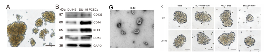 分子探针与表观遗传学研究好文分享：AGD1/USP10/METTL13复合物通过CD44 m6A修饰增强肿瘤干细胞增殖，降低多西紫杉醇对去雄耐药性前列腺癌的治疗作用