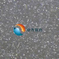 人胰腺星状细胞-永生化 