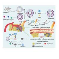 血小板外泌体-光热敏感脂质体杂化纳米颗粒包载葡萄糖氧化酶(Gox)和柠檬酸铁铵(FAC)