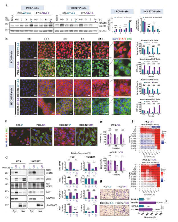 image.png 国立成功大学团队揭示糖基化缺陷的IL-6调控肺癌进展及耐药的新机制