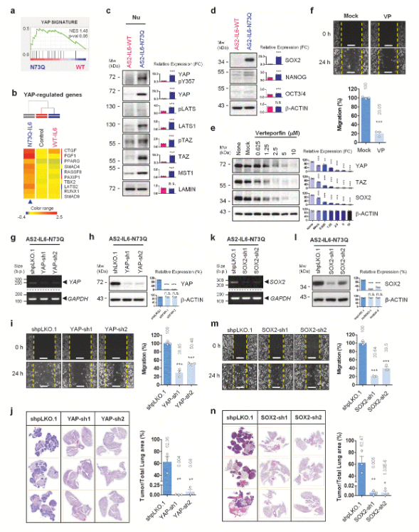 image.png 国立成功大学团队揭示糖基化缺陷的IL-6调控肺癌进展及耐药的新机制