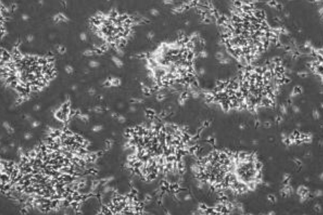 影响微生物生长的因素是温度分析