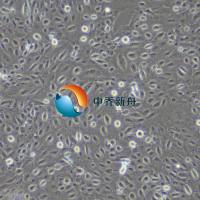 人睾丸间质细胞-永生化