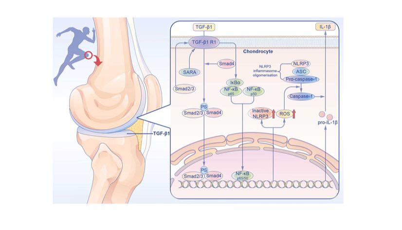 机械应力通过骨关节炎模型中 TGF-β1 介导的 Smad2/3 激活和NF-κB 抑制来防止软骨细胞焦亡