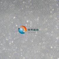 HAEC-Immortalized 人主动脉内皮细胞-永生化